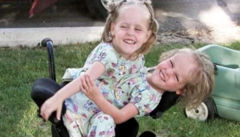 The Inspiring Journey of Kendra and Malia: From Conjoined Twins to Independent Young Women